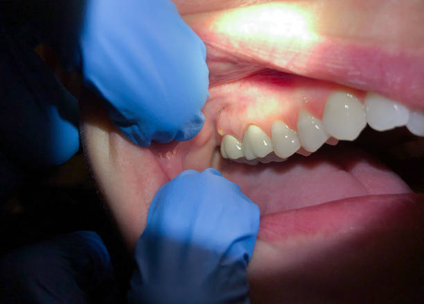 Best Teeth Whitening  in Lone Pine, CA