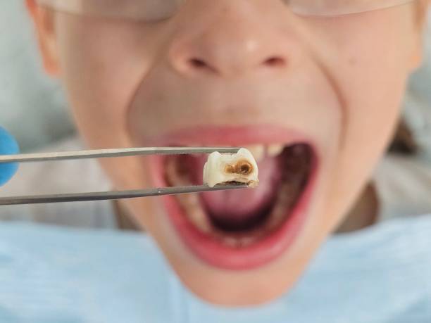 Best Broken Tooth Emergency  in Lone Pine, CA