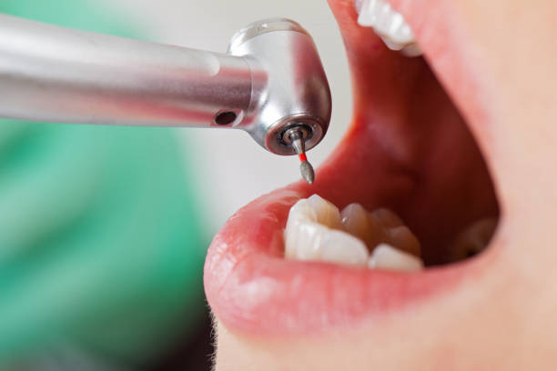 Best Dentist for Tooth Abscess  in Lone Pine, CA